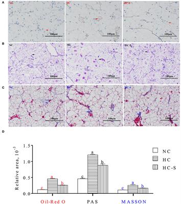 Dietary Macroalgae Saccharina japonica Ameliorates Liver Injury Induced by a High-Carbohydrate Diet in Swamp Eel (Monopterus albus)